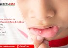 Home Remedies for Mouth Ulcers in Children