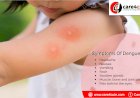 Dengue Fever: Facts, Causes, Symptoms, and Treatments