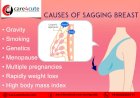 How to prevent breast sagging?