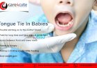 Tongue-tie in babies