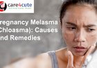 Pregnancy Melasma (Chloasma): Causes And Remedies