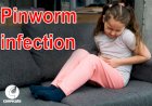 Pinworm Infection: Cause, Symptoms, Treatment