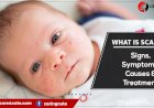 What is Scabies and how it is treated?