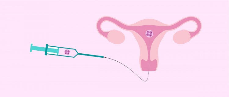 Popular Reproductive Surgeries to help with Infertility