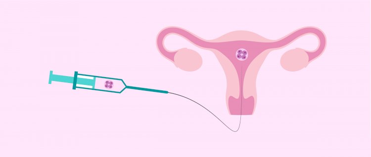 Popular Reproductive Surgeries to help with Infertility