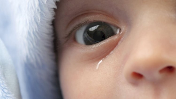 How to get rid of blocked tear duct?