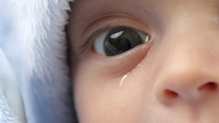 How to get rid of blocked tear duct?