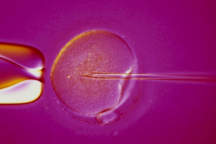 Various Artificial Reproductive Treatments to Get Rid Of Infertility