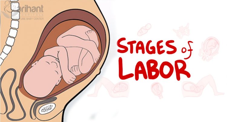 The Stages of Labor and Birth in a Vaginal Delivery