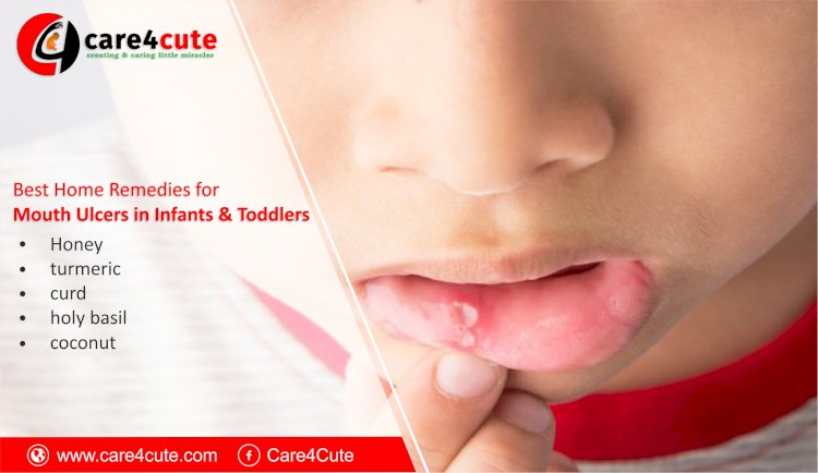 Home Remedies for Mouth Ulcers in Children