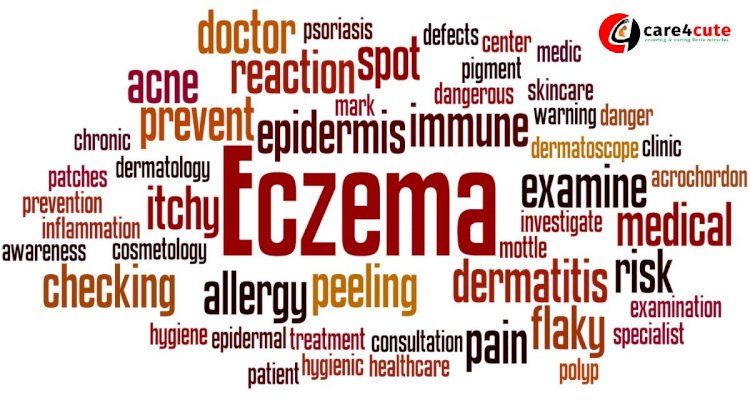 Nationa Eczema Week 2019