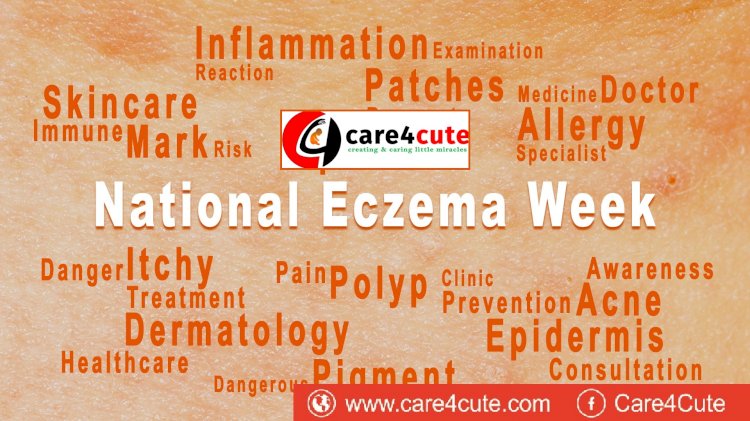 15 Sep to 22 Sep - National Eczema Week 2019