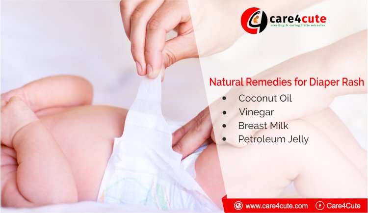 6 Best Home Remedies for Diaper Rash in Babies