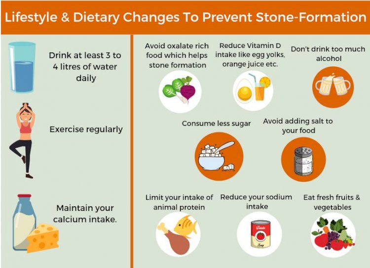 Kidney Stone Formation Prevention 