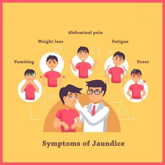 Infant Jaundice  Symptoms 