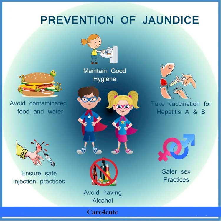 Infant Jaundice  Preventions