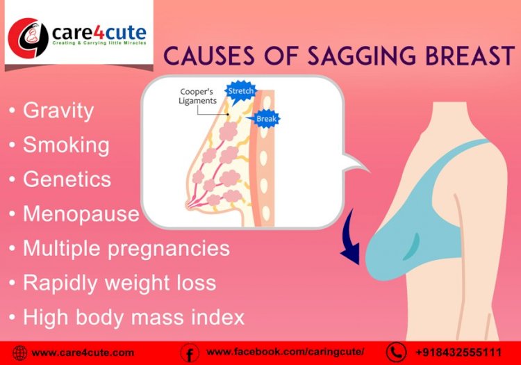 How to prevent breast sagging?