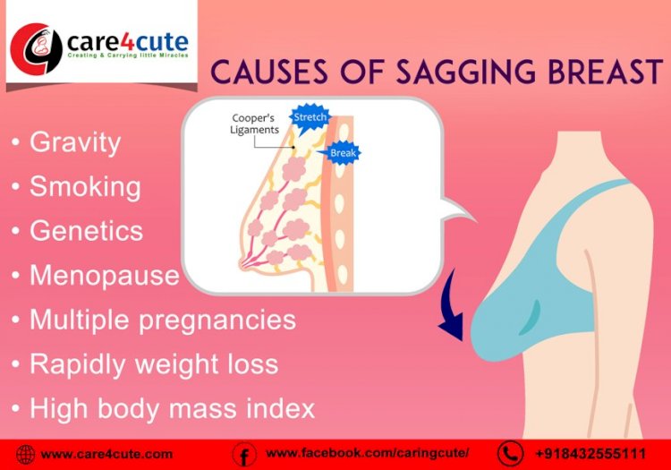 Premature Breast Sagging Is Common; Here's What You Can Do To