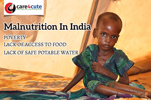 Malnutrition In India