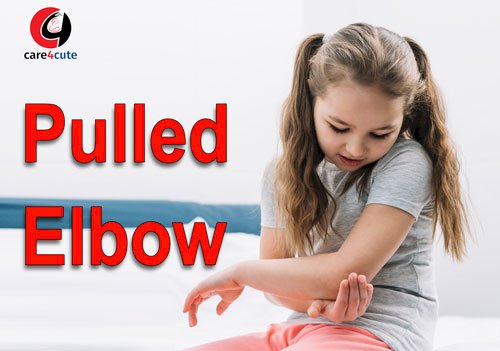 Pulled Elbow: Cause, Symptoms, Treatment