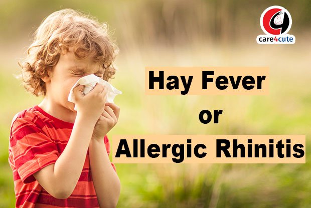 Hay Fever (Allergic Rhinitis)