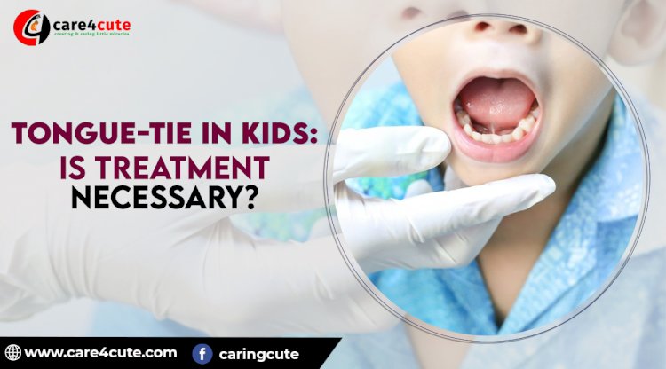 Tongue-tie in Kids: Is Treatment Necessary?