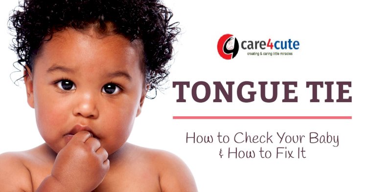 Tongue-tie in Kids